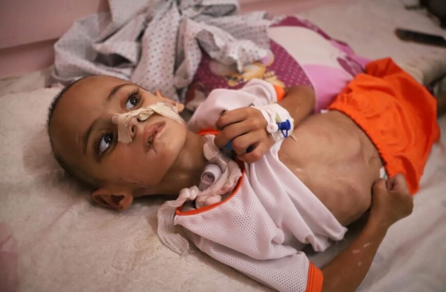Gaza toddler with shrapnel in brain fights for life after family killed
